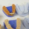 schaumodelle patientenaufklärung UK und OK zahntechnik 3764 – Bild 3